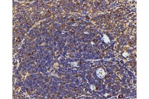 Immunohistochemistry analysis of paraffin-embedded Rat spleen using IL22RA1 Polyclonal Antibody at dilution of 1:200. (IL22 Receptor alpha 1 anticorps)