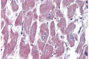 Human Heart (formalin-fixed, paraffin-embedded) stained with GPR116 antibody ABIN399995 at 10 ug/ml followed by biotinylated goat anti-rabbit IgG secondary antibody ABIN481713, alkaline phosphatase-streptavidin and chromogen. (G Protein-Coupled Receptor 116 anticorps  (Internal Region))