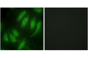 Immunofluorescence analysis of HeLa cells, using HEXIM1 Antibody. (HEXIM1 anticorps  (AA 181-230))