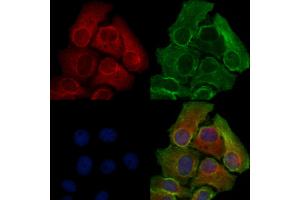 ABIN6258983 and ABIN6276069 staining Hela cells by IF/ICC.