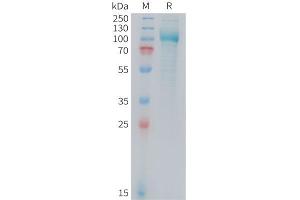 Mouse PSMA Protein, His Tag on SDS-PAGE under reducing condition.