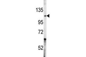 Western blot analysis of c-Abl antibody and A2058 lysate.