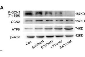 BCAA increase PPAR-α expression in a GCN2/ATF6 pathway-dependent manner. (beta Actin anticorps)