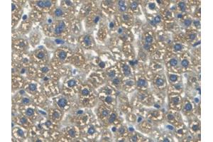 DAB staining on IHC-P; Samples: Mouse Liver Tissue