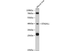 Western blot analysis of extracts of mouse liver, using ST3G antibody (ABIN6130190, ABIN6148520, ABIN6148522 and ABIN6215305) at 1:3000 dilution. (ST3GAL1 anticorps  (AA 35-135))