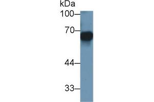 Mouse Capture antibody from the kit in WB with Positive Control: Human SGC7901 cell lysate. (MMP3 Kit CLIA)