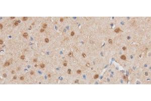 Immunohistochemistry of paraffin-embedded Mouse brain using MAP2K6 Polyclonal Antibody at dilution of 1:50 (MAP2K6 anticorps)