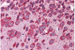 anti-F-Box and WD Repeat Domain Containing 7 (FBXW7) (AA 251-300) antibody