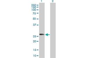Western Blot analysis of RABL2B expression in transfected 293T cell line by RABL2B MaxPab polyclonal antibody.
