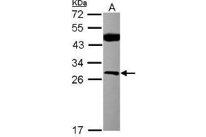 WB Image Sample (30 ug of whole cell lysate) A: MCF-7 12% SDS PAGE antibody diluted at 1:500 (CSNK2B anticorps)