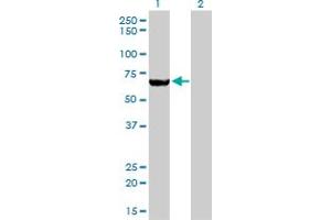 Western Blot analysis of MTMR2 expression in transfected 293T cell line by MTMR2 monoclonal antibody (M03), clone 4G6. (MTMR2 anticorps  (AA 5-100))
