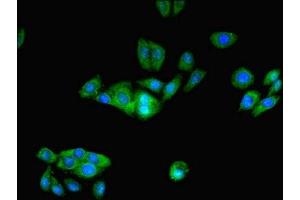 Immunofluorescent analysis of HepG2 cells using ABIN7164206 at dilution of 1:100 and Alexa Fluor 488-congugated AffiniPure Goat Anti-Rabbit IgG(H+L) (PFDN1 anticorps  (AA 2-122))