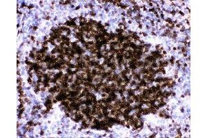 IHC-P: CD23 antibody testing of mouse spleen tissue (FCER2 anticorps  (AA 50-331))