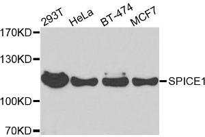 Western blot analysis of extracts of various cells, using SPICE1 antibody. (SPICE1 anticorps)