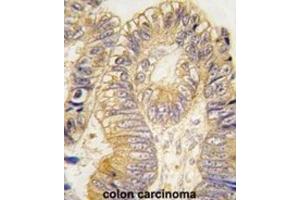 Immunohistochemistry (IHC) image for anti-Chloride Intracellular Channel 5 (CLIC5) antibody (ABIN3003306)