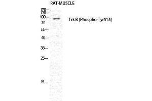 Western Blotting (WB) image for anti-Neurotrophic Tyrosine Kinase, Receptor, Type 2 (NTRK2) (pTyr516) antibody (ABIN3182168) (TRKB anticorps  (pTyr516))