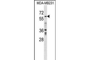 ZN Antibody (N-term) (ABIN1539343 and ABIN2849295) western blot analysis in MDA-M cell line lysates (35 μg/lane). (ZNF543 anticorps  (N-Term))