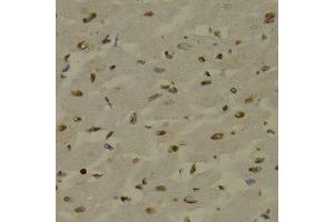 Immunohistochemistry of paraffin-embedded rat heart using NFKB2 Antibody.