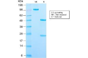 SDS-PAGE Analysis Purified CD209 Recombinant Rabbit Monoclonal Antibody (C209/2749R).