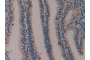 Detection of KL in Mouse Oviduct Tissue using Polyclonal Antibody to Klotho (KL)