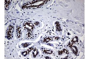 Image no. 2 for anti-Nibrin (NBN) (AA 183-460) antibody (ABIN1491059) (Nibrin anticorps  (AA 183-460))