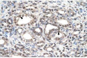 Human kidney (DFNA5 anticorps  (C-Term))