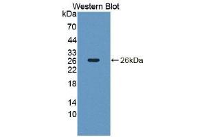 Western blot analysis of the recombinant protein. (NT5C anticorps  (AA 12-200))