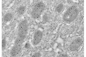 Immunoelectron microscopy analysis of LR white resin-embedded mouse liver using HSP60 (ABIN7074167) at dilution of 1: 50.