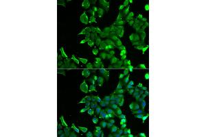 Immunofluorescence analysis of HeLa cells using STOM antibody (ABIN5973779). (Stomatin anticorps)