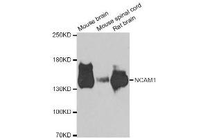 Western blot analysis of extracts of various cell lines, using NCAM1 antibody. (CD56 anticorps  (AA 759-858))