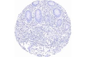 anti-T-Box 1 (TBX1) antibody