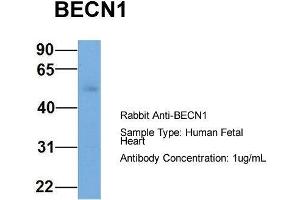 Host: Rabbit  Target Name: BECN1  Sample Tissue: Human Fetal Heart  Antibody Dilution: 1. (Beclin 1 anticorps  (Middle Region))
