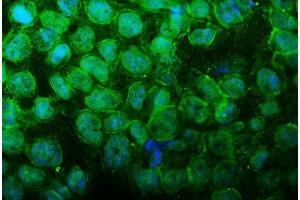 IF analysis of UBR2 using anti-UBR2 antibody (ABIN7599609). (UBR2 anticorps  (AA 10-664))