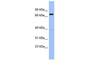 WB Suggested Anti-RGS9 Antibody Titration: 0. (RGS anticorps  (Middle Region))