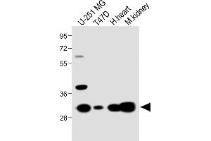 All lanes : Anti-RCH5 Antibody (N-term) at 1:1000 dilution Lane 1: U-251 MG whole cell lysate Lane 2: T47D whole cell lysate Lane 3: Hun heart lysate Lane 4: Mouse kidney lysate Lysates/proteins at 20 μg per lane. (MARCH5 anticorps  (N-Term))