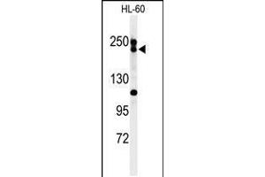 Western blot analysis of BLM Antibody in HL-60 cell line lysates (35ug/lane) (BLM anticorps  (C-Term))