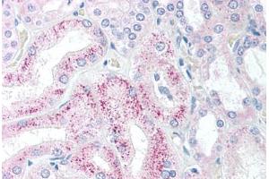 Human Kidney (formalin-fixed, paraffin-embedded) stained with AES antibody ABIN213897 at 5 ug/ml followed by biotinylated goat anti-rabbit IgG secondary antibody ABIN481713, alkaline phosphatase-streptavidin and chromogen. (AES anticorps  (N-Term))