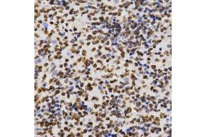 Immunohistochemistry of paraffin-embedded human kidney using DiMethyl-Histone H3-K27 antibody.
