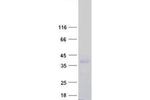 Validation with Western Blot