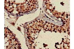 Immunohistochemistry of paraffin-embedded human testis tissue using ABIN7168160 at dilution of 1:100 (PRPS2 anticorps  (AA 11-106))
