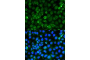 Immunofluorescence analysis of A549 cell using HIST2H4B antibody.