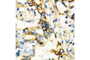Anti-TNF Receptor I antibody, IHC(P) IHC(P): Human Mammary Tissue (TNFRSF1A anticorps  (Middle Region))
