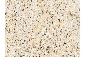 Phospho-ZEB2 (Ser784) Antibody at 1/100 staining Rat heart tissue by IHC-P.