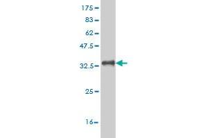Western Blot detection against Immunogen (31.