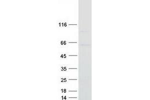 Validation with Western Blot
