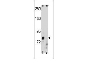 ZT1 Antibody (C-term) (ABIN1882011 and ABIN2843232) western blot analysis in HepG2 cell line lysates (35 μg/lane). (ZMAT1 anticorps  (C-Term))