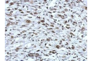 IHC-P Image Immunohistochemical analysis of paraffin-embedded C2C12 xenograft, using RAD21, antibody at 1:750 dilution.