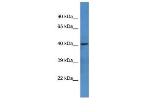 Western Blotting (WB) image for anti-Netrin G1 (NTNG1) (C-Term) antibody (ABIN2788417) (Netrin G1 anticorps  (C-Term))