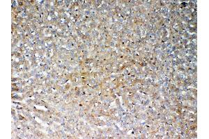 IHC analysis of GALNS using anti-GALNS antibody .