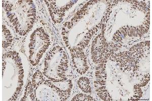 IHC analysis of PC4/SUB1 using anti-PC4/SUB1 antibody (ABIN7602185). (SUB1 anticorps  (AA 62-127))
